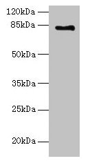 LCA5 Antibody - Western blot All lanes: LCA5 antibody at 18µg/ml + Mouse kidney tissue Secondary Goat polyclonal to rabbit IgG at 1/10000 dilution Predicted band size: 81 kDa Observed band size: 81 kDa