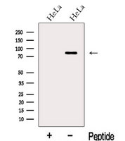 LCA5 Antibody - Western blot analysis of extracts of HeLa cells using LCA5 antibody. The lane on the left was treated with blocking peptide.