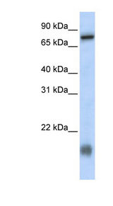 LCA5L Antibody - LCA5L / C21orf13 antibody Western blot of MCF7 cell lysate. This image was taken for the unconjugated form of this product. Other forms have not been tested.
