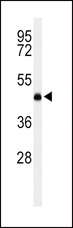 LCAT Antibody - Western blot of LCAT Antibody in K562 cell line lysates (35 ug/lane). LCAT (arrow) was detected using the purified antibody.