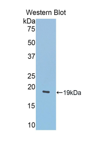 LCAT Antibody - Western blot of recombinant LCAT.  This image was taken for the unconjugated form of this product. Other forms have not been tested.