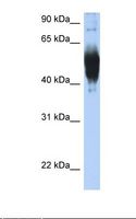 LCAT Antibody - Transfected 293T cell lysate. Antibody concentration: 1.0 ug/ml. Gel concentration: 12%.  This image was taken for the unconjugated form of this product. Other forms have not been tested.