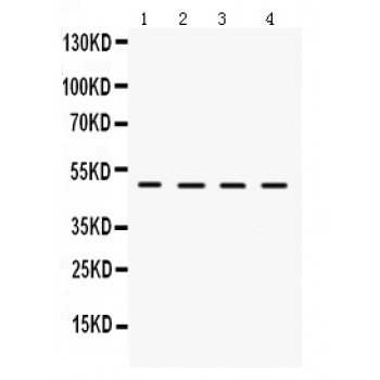 LCAT Antibody - LCAT antibody Western blot. All lanes: Anti LCAT at 0.5 ug/ml. Lane 1: Rat Brain Tissue Lysate at 50 ug. Lane 2: Mouse Testis Tissue Lysate at 50 ug. Lane 3: HEPG2 Whole Cell Lysate at 40 ug. Lane 4: HELA Whole Cell Lysate at 40 ug. Predicted band size: 50 kD. Observed band size: 50 kD.