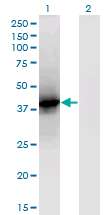 LCAT Antibody - Western Blot analysis of LCAT expression in transfected 293T cell line by LCAT monoclonal antibody (M01), clone 4A9.Lane 1: LCAT transfected lysate (Predicted MW: 49.6 KDa).Lane 2: Non-transfected lysate.
