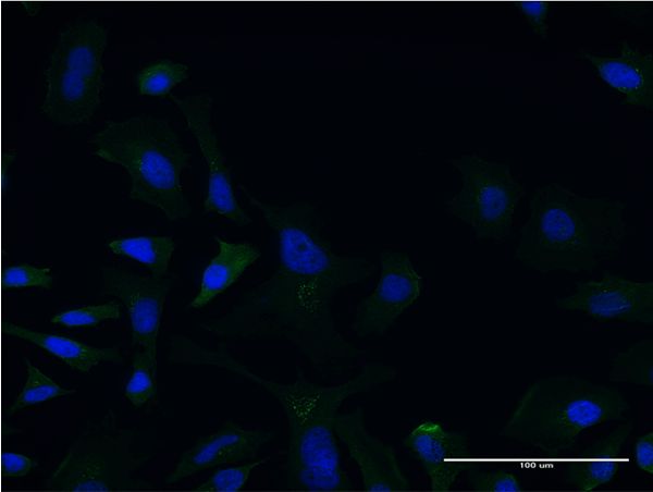 LCAT Antibody - Immunofluorescence of monoclonal antibody to LCAT on HeLa cell . [antibody concentration 10 ug/ml]