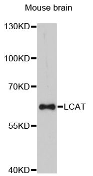 LCAT Antibody - Western blot analysis of extracts of mouse brain, using LCAT antibody at 1:3000 dilution. The secondary antibody used was an HRP Goat Anti-Rabbit IgG (H+L) at 1:10000 dilution. Lysates were loaded 25ug per lane and 3% nonfat dry milk in TBST was used for blocking. An ECL Kit was used for detection and the exposure time was 90s.