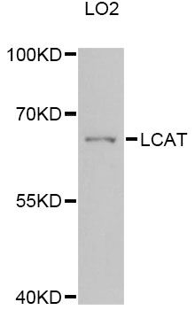 LCAT Antibody - Western blot analysis of extracts of LO2 cells, using LCAT Antibody at 1:3000 dilution. The secondary antibody used was an HRP Goat Anti-Rabbit IgG (H+L) at 1:10000 dilution. Lysates were loaded 25ug per lane and 3% nonfat dry milk in TBST was used for blocking. An ECL Kit was used for detection and the exposure time was 90s.