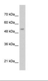 LCAT Antibody - HepG2 Cell Lysate.  This image was taken for the unconjugated form of this product. Other forms have not been tested.