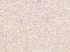 LCAT Antibody - Immunochemical staining of human LCAT in human liver with rabbit polyclonal antibody at 1:1000 dilution, formalin-fixed paraffin embedded sections.