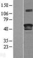 LCAT Protein - Western validation with an anti-DDK antibody * L: Control HEK293 lysate R: Over-expression lysate