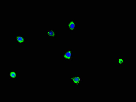 LCE1B Antibody - Immunofluorescent analysis of A375 cells using LCE1B Antibody at a dilution of 1:100 and Alexa Fluor 488-congugated AffiniPure Goat Anti-Rabbit IgG(H+L)