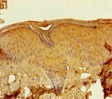 LCE2A Antibody - Immunohistochemistry of paraffin-embedded human skin tissue using LCE2A Antibody at dilution of 1:100