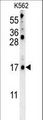 LCE2B Antibody - LCE2B Antibody western blot of K562 cell line lysates (35 ug/lane). The LCE2B antibody detected the LCE2B protein (arrow).