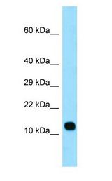 LCE3C Antibody - LCE3C antibody Western Blot of Fetal Lung.  This image was taken for the unconjugated form of this product. Other forms have not been tested.