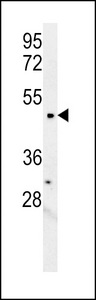LCLAT1 Antibody - LCLT1 Antibody western blot of mouse kidney tissue lysates (15 ug/lane). The LCLT1 antibody detected LCLT1 protein (arrow).