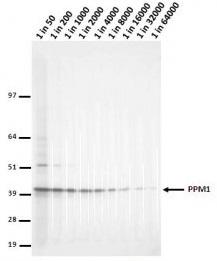 LCMT1 Antibody - NIH Purolysate run on 4-12% Bis-Tris 2D gel in 1xMOPS running buffer. Transfer to 0.45um nitrocellulose. Membrane probed with 4A4 (anti-PPM1). Anti-mouse IgG (whole molecule)-AP conjugate (1 in 2000). Detection with BCIP/NBT substrate.