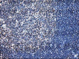 LCMT1 Antibody - IHC of paraffin-embedded Human lymph node tissue using anti-LCMT1 mouse monoclonal antibody.