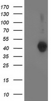 LCMT1 Antibody - HEK293T cells were transfected with the pCMV6-ENTRY control (Left lane) or pCMV6-ENTRY LCMT1 (Right lane) cDNA for 48 hrs and lysed. Equivalent amounts of cell lysates (5 ug per lane) were separated by SDS-PAGE and immunoblotted with anti-LCMT1.