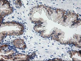 LCMT1 Antibody - IHC of paraffin-embedded Human prostate tissue using anti-LCMT1 mouse monoclonal antibody.
