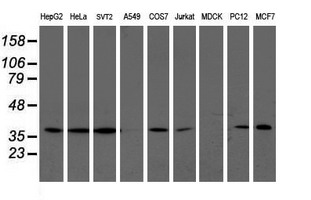 LCMT1 Antibody - Western blot of extracts (35 ug) from 9 different cell lines by using anti-LCMT1 monoclonal antibody.