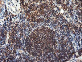 LCMT1 Antibody - IHC of paraffin-embedded Human tonsil using anti-LCMT1 mouse monoclonal antibody.