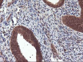 LCMT1 Antibody - IHC of paraffin-embedded Human endometrium tissue using anti-LCMT1 mouse monoclonal antibody.