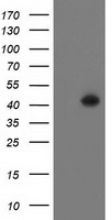 LCMT1 Antibody - HEK293T cells were transfected with the pCMV6-ENTRY control (Left lane) or pCMV6-ENTRY LCMT1 (Right lane) cDNA for 48 hrs and lysed. Equivalent amounts of cell lysates (5 ug per lane) were separated by SDS-PAGE and immunoblotted with anti-LCMT1.