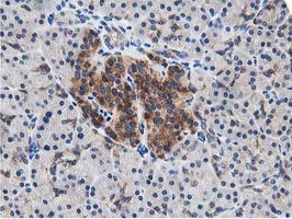 LCMT1 Antibody - IHC of paraffin-embedded Human pancreas tissue using anti-LCMT1 mouse monoclonal antibody.