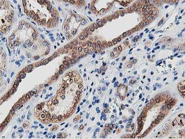 LCMT1 Antibody - IHC of paraffin-embedded Human Kidney tissue using anti-LCMT1 mouse monoclonal antibody.