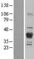 LCMT1 Protein - Western validation with an anti-DDK antibody * L: Control HEK293 lysate R: Over-expression lysate