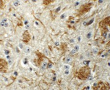 LCMT2 / YW4 Antibody - Immunohistochemistry of TYW4 in mouse brain tissue with TYW4 antibody at 5 ug/ml.
