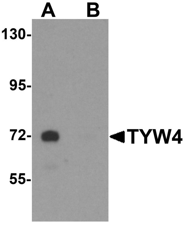 LCMT2 / YW4 Antibody - Western blot analysis of TYW4 in rat brain tissue lysate with TYW4 antibody at 1 ug/ml in (A) the absence and (B) the presence of blocking peptide.