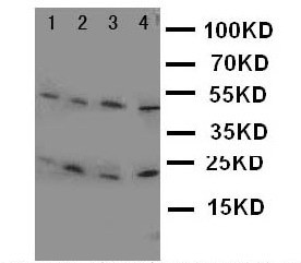 LCN1 / Lipocalin-1 Antibody - WB of LCN1 antibody. Lane 1: JURKAT Cell Lysate. Lane 2: COLO320 Cell Lysate. Lane 3: SCG Cell Lysate. Lane 4: HELA Cell Lysate.
