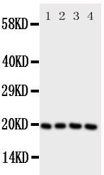 LCN1 / Lipocalin-1 Antibody - Anti-LCN1 antibody, Western blotting All lanes: Anti LCN1 at 0.5ug/ml Lane 1: JURKAT Whole Cell Lysate at 40ug Lane 2: COLO320 Whole Cell Lysate at 40ug Lane 3: SCG Whole Cell Lysate at 40ug Lane 4: HELA Whole Cell Lysate at 40ug Predicted bind size: 19KD Observed bind size: 19KD