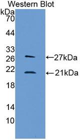 LCN1 / Lipocalin-1 Antibody - Western Blot; Sample: Recombinant protein