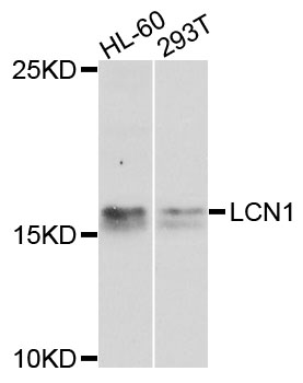 LCN1 / Lipocalin-1 Antibody - Western blot analysis of extracts of various cells.
