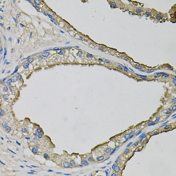 LCN1 / Lipocalin-1 Antibody - Immunohistochemistry of paraffin-embedded human prostate.