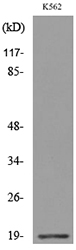 LCN1 / Lipocalin-1 Antibody - Western blot analysis of lysate from K562 cells, using LCN1 Antibody.