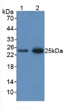 LCN2 / Lipocalin 2 / NGAL Antibody - Western Blot; Sample: Lane1: Rat Lung Tissue; Lane2: Rat Spleen Tissue.