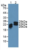 LCN2 / Lipocalin 2 / NGAL Antibody - Western Blot; Sample: Lane1: Human SW480 Cells; Lane2: Human Urine.