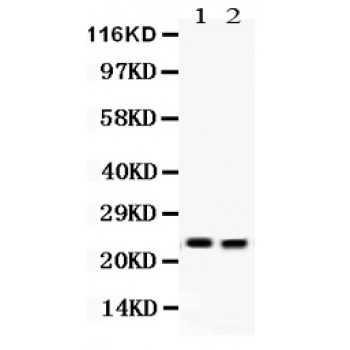LCN2 / Lipocalin 2 / NGAL Antibody - Lipocalin 2 antibody Western blot. All lanes: Anti Lipocalin 2 at 0.5 ug/ml. Lane 1: Mouse Lung Tissue Lysate at 50 ug. Lane 2: Mouse Intestine Tissue Lysate at 50 ug. Predicted band size: 22 kD. Observed band size: 22 kD.