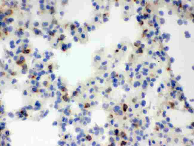 LCN2 / Lipocalin 2 / NGAL Antibody - IHC analysis of Lipocalin 2 using anti-Lipocalin 2 antibody. Lipocalin 2 was detected in frozen section of mouse lung tissue . Heat mediated antigen retrieval was performed in citrate buffer (pH6, epitope retrieval solution) for 20 mins. The tissue section was blocked with 10% goat serum. The tissue section was then incubated with 1µg/ml rabbit anti-Lipocalin 2 Antibody overnight at 4°C. Biotinylated goat anti-rabbit IgG was used as secondary antibody and incubated for 30 minutes at 37°C. The tissue section was developed using Strepavidin-Biotin-Complex (SABC) with DAB as the chromogen.