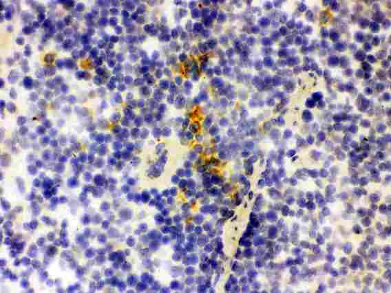 LCN2 / Lipocalin 2 / NGAL Antibody - IHC analysis of Lipocalin 2 using anti-Lipocalin 2 antibody. Lipocalin 2 was detected in frozen section of mouse spleen tissue . Heat mediated antigen retrieval was performed in citrate buffer (pH6, epitope retrieval solution) for 20 mins. The tissue section was blocked with 10% goat serum. The tissue section was then incubated with 1µg/ml rabbit anti-Lipocalin 2 Antibody overnight at 4°C. Biotinylated goat anti-rabbit IgG was used as secondary antibody and incubated for 30 minutes at 37°C. The tissue section was developed using Strepavidin-Biotin-Complex (SABC) with DAB as the chromogen.