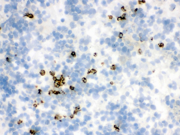 LCN2 / Lipocalin 2 / NGAL Antibody - IHC analysis of Lipocalin 2 using anti-Lipocalin 2 antibody. Lipocalin 2 was detected in frozen section of rat spleen tissue . Heat mediated antigen retrieval was performed in citrate buffer (pH6, epitope retrieval solution) for 20 mins. The tissue section was blocked with 10% goat serum. The tissue section was then incubated with 1µg/ml rabbit anti-Lipocalin 2 Antibody overnight at 4°C. Biotinylated goat anti-rabbit IgG was used as secondary antibody and incubated for 30 minutes at 37°C. The tissue section was developed using Strepavidin-Biotin-Complex (SABC) with DAB as the chromogen.
