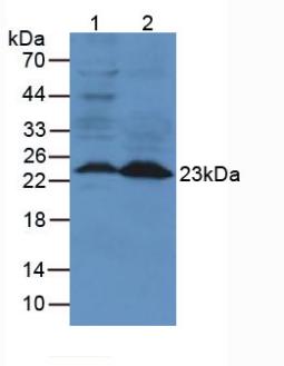 LCN2 / Lipocalin 2 / NGAL Antibody - Western Blot; Sample: Lane1: Mouse Lung Tissue; Lane2: Mouse Spleen Tissue.