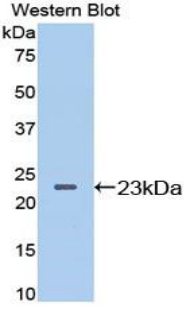 LCN2 / Lipocalin 2 / NGAL Antibody - Western blot of recombinant LCN2 / Lipocalin 2 / NGAL.  This image was taken for the unconjugated form of this product. Other forms have not been tested.