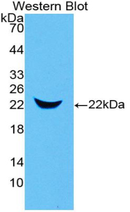 LCN2 / Lipocalin 2 / NGAL Antibody - Western Blot; Sample: Recombinant NGAL, Mouse.