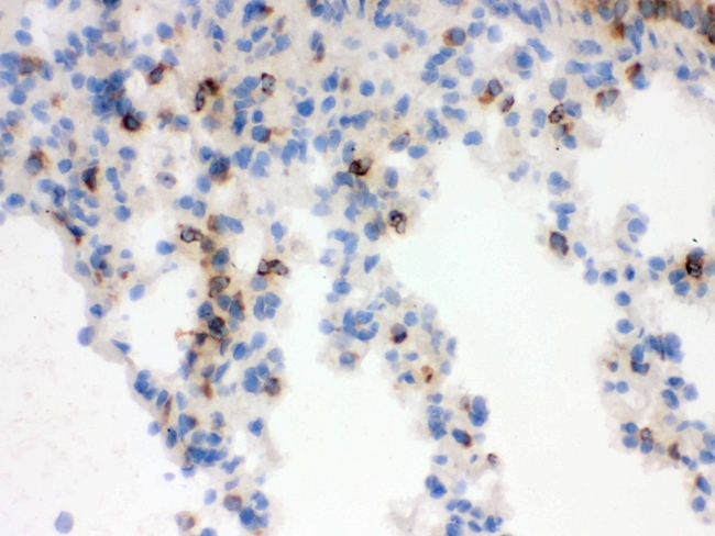 LCN2 / Lipocalin 2 / NGAL Antibody - IHC analysis of Lipocalin 2 using anti-Lipocalin 2 antibody. Lipocalin 2 was detected in frozen section of mouse lung tissue . Heat mediated antigen retrieval was performed in citrate buffer (pH6, epitope retrieval solution) for 20 mins. The tissue section was blocked with 10% goat serum. The tissue section was then incubated with 1µg/ml rabbit anti-Lipocalin 2 Antibody overnight at 4°C. Biotinylated goat anti-rabbit IgG was used as secondary antibody and incubated for 30 minutes at 37°C. The tissue section was developed using Strepavidin-Biotin-Complex (SABC) with DAB as the chromogen.