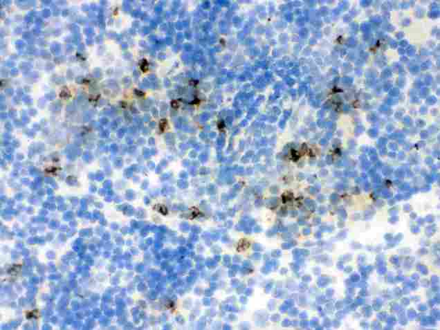 LCN2 / Lipocalin 2 / NGAL Antibody - IHC analysis of Lipocalin 2 using anti-Lipocalin 2 antibody. Lipocalin 2 was detected in frozen section of mouse spleen tissue . Heat mediated antigen retrieval was performed in citrate buffer (pH6, epitope retrieval solution) for 20 mins. The tissue section was blocked with 10% goat serum. The tissue section was then incubated with 1µg/ml rabbit anti-Lipocalin 2 Antibody overnight at 4°C. Biotinylated goat anti-rabbit IgG was used as secondary antibody and incubated for 30 minutes at 37°C. The tissue section was developed using Strepavidin-Biotin-Complex (SABC) with DAB as the chromogen.