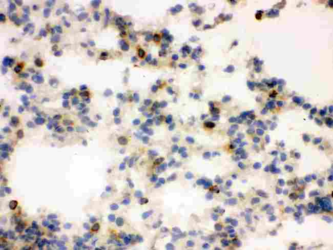 LCN2 / Lipocalin 2 / NGAL Antibody - IHC analysis of Lipocalin 2 using anti-Lipocalin 2 antibody. Lipocalin 2 was detected in frozen section of rat lung tissue . Heat mediated antigen retrieval was performed in citrate buffer (pH6, epitope retrieval solution) for 20 mins. The tissue section was blocked with 10% goat serum. The tissue section was then incubated with 1µg/ml rabbit anti-Lipocalin 2 Antibody overnight at 4°C. Biotinylated goat anti-rabbit IgG was used as secondary antibody and incubated for 30 minutes at 37°C. The tissue section was developed using Strepavidin-Biotin-Complex (SABC) with DAB as the chromogen.